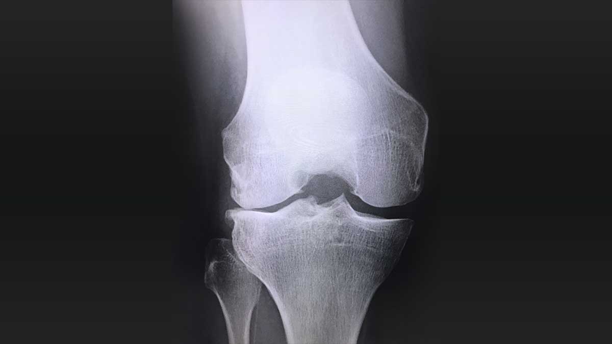 変形性関節症についてどのような医師に診てもらうべきかをどうやって知ることができますか?