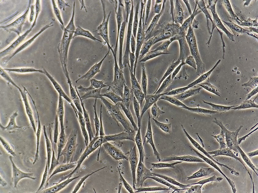 Dermal fibroblasts