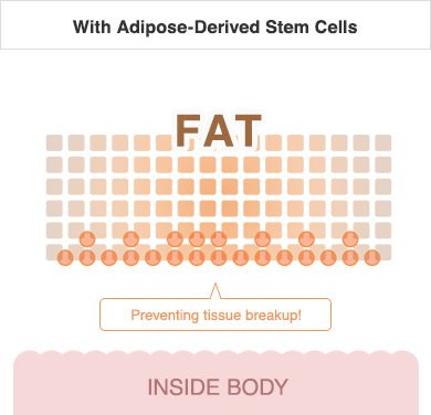 With Adipose-Derived Stem Cells